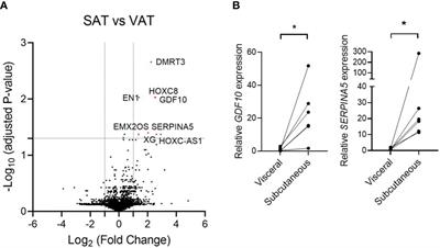 GDF10 is related to obesity as an adipokine derived from subcutaneous adipose tissue
